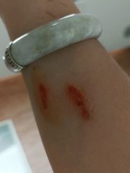 -比华利美容医院