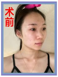 -苏州奥拉克美容医院
