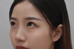-天津健丽·去眼袋医疗美容机构
