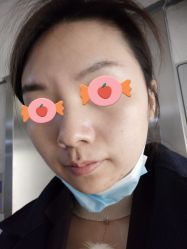 体验后-深圳原色医疗美容