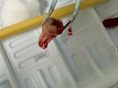 -上海仁爱医院口腔科 · 种植