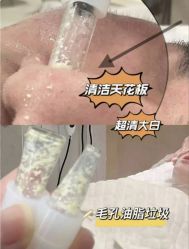 -SKIN79皮肤管理中心