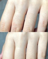 -薇兰专业脱毛连锁机构