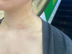 体验前-重庆军科整形美容医院