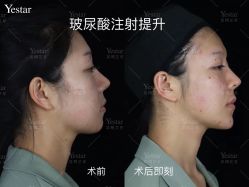 -Yestar艺星医疗美容医院