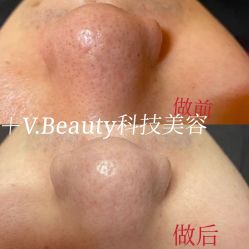 点击看大图 -苑苑vbeauty科技美容SPA