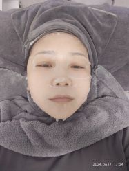 体验后-医方嘉明医疗美容