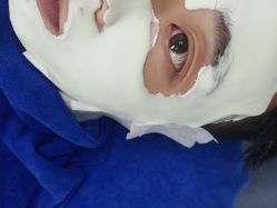 -蕾特恩专业祛痘