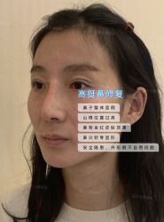 -北京米扬丽格医疗美容·联合丽格鼻整形中心