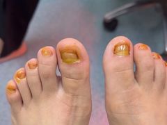 -新甲连锁灰指甲·甲沟炎·鸡眼(黑龙江路店)