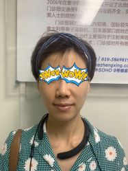 -八大处整形