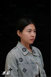 -Yestar重庆艺星医疗美容医院
