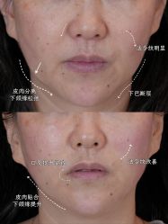 -Yestar重庆艺星医疗美容医院