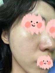 体验前-恒妍医美·韩国定制抗衰中心