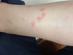 -五七小李子油焖大虾(总店)