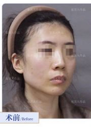 -圣嘉新医疗美容医院