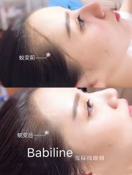 -babiline芭比莱恩半永久纹眉纹唇发际线