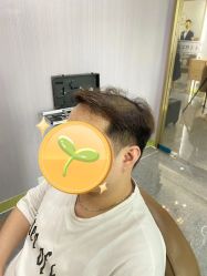 -发饰美男士增发补发假发定制店