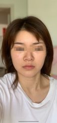 -贵阳美莱医疗美容整形医院