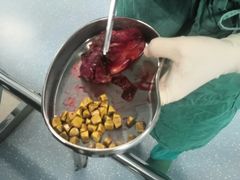 -武汉大学人民医院(首义院区)