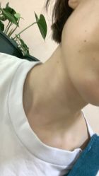 -北京美痣堂古方祛痣斑疣瘊