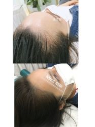 -MISS STAR·半永久纹眉·发际线·美瞳线