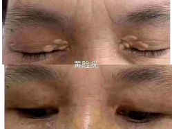 -美人痣全国连锁