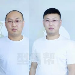 -型男帮男士假发补发·佩戴式发型