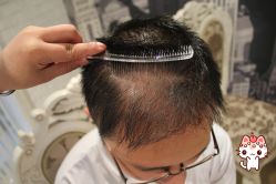 -大麦微针植发丨全国连锁