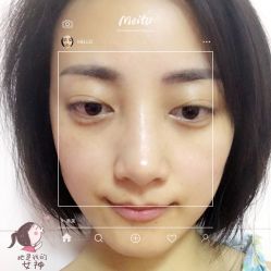 点击看大图 -美莱医学美容医院