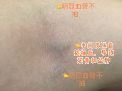 -南方医科大学深圳医院