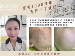 -万阡国际专业祛斑·祛痣·祛疤连锁