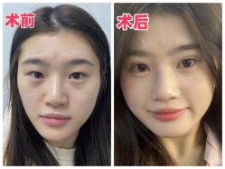 -素美医疗美容·西南眼鼻整形·修复基地