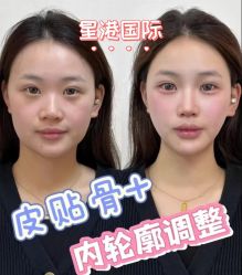 -星港国际·Skin皮肤专研·皮肤管理