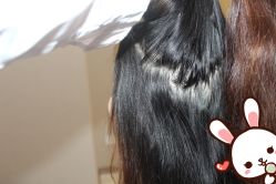 -大麦微针植发丨全国连锁