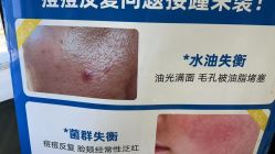 -苗医生0感祛痘连锁