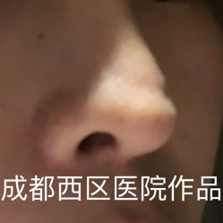 体验后-成都西区医院整形美容