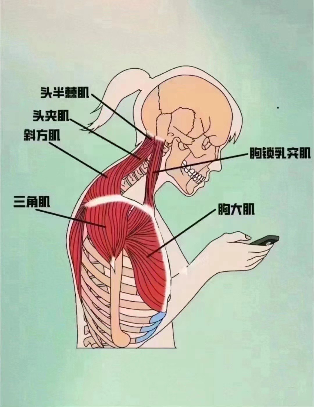 胸锁乳突肌不对称图片图片