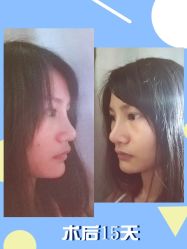 -广东韩妃整形外科医院
