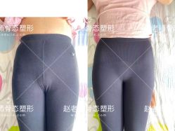-梦斯绮私密催乳修复中心