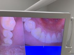 -土豆口腔(凤凰北总店)