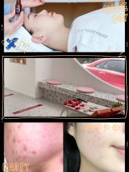 -苗方清颜痘肌研究所