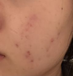 体验后-上海玫瑰医疗美容医院