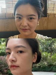 -Yestar 嘉兴艺星医疗美容医院