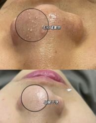 -Cream88颜皮肤管理中心