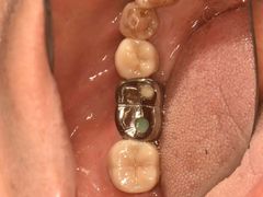 -精德口腔·种植修复·儿牙中心(财富中心店)