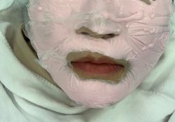 -蕾特恩专业祛痘·皮肤管理