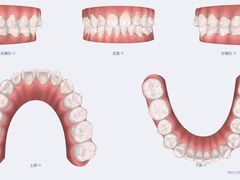-同步齿科·数字化正畸种植口腔中心(前山店)