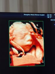 -郑州万安妇产医院