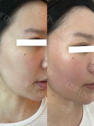 -AURAS璈然科技护肤中心